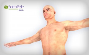 Foto Implantes SottoPelle
